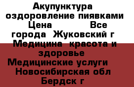 Акупунктура, оздоровление пиявками › Цена ­ 3 000 - Все города, Жуковский г. Медицина, красота и здоровье » Медицинские услуги   . Новосибирская обл.,Бердск г.